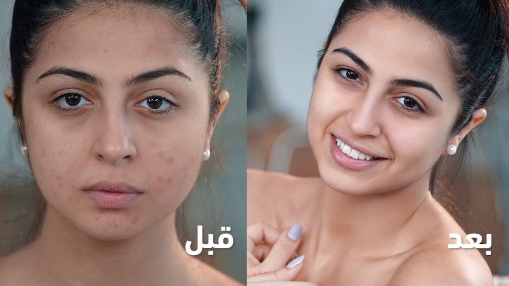 Layla Akil Sits Down With Dermatologist Dr. Malda To Talk Skincare on Mazaj