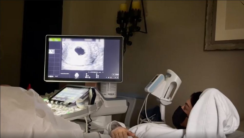 KYLIE JENNER, PREGNANT WITH HER SECOND CHILD