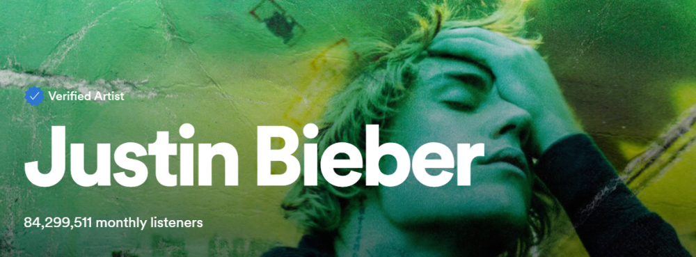 Do you have the Bieber fever?